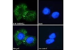 NCEH1 Antikörper  (C-Term)