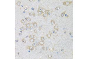 Immunohistochemistry of paraffin-embedded rat brain using CHMP1B antibody (ABIN5974811) at dilution of 1/100 (40x lens).