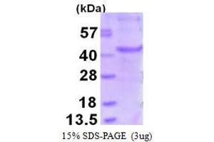 Image no. 1 for Melanoma Antigen Family A, 6 (MAGEA6) protein (His tag) (ABIN6386967) (MAGEA6 Protein (His tag))