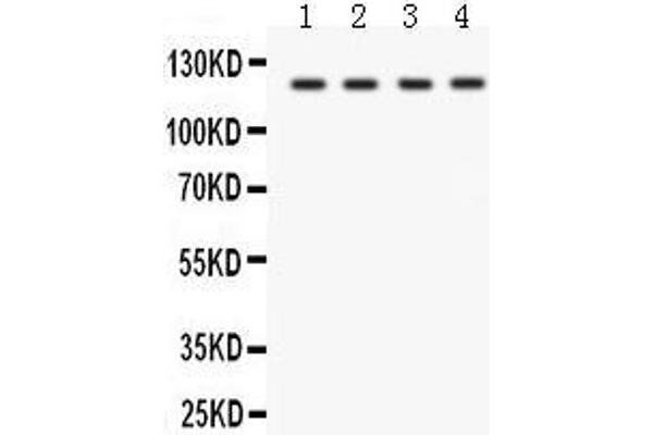 SLC12A1 Antikörper  (N-Term)