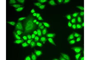 Immunofluorescence analysis of MCF-7 cells using RNF40 antibody. (RNF40 Antikörper)