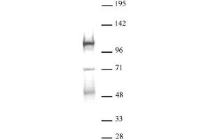 DNMT3B antibody (pAb) tested by Western blot. (DNMT3B Antikörper  (AA 1-218))