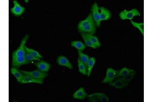 Immunofluorescence staining of HepG2 cells with ABIN7149404 at 1:100, counter-stained with DAPI. (PLA2G4B Antikörper  (AA 514-781))