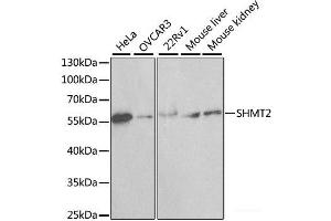 Western blot analysis of extracts of various cell lines using SHMT2 Polyclonal Antibody at dilution of 1:1000.
