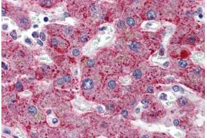 Human Liver: Formalin-Fixed, Paraffin-Embedded (FFPE) (SERPING1 Antikörper  (AA 1-501))