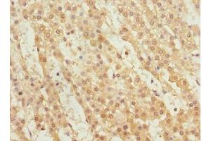 Immunohistochemistry (IHC) image for anti-Wingless-Type MMTV Integration Site Family, Member 9A (WNT9A) (AA 206-365) antibody (ABIN7166319)