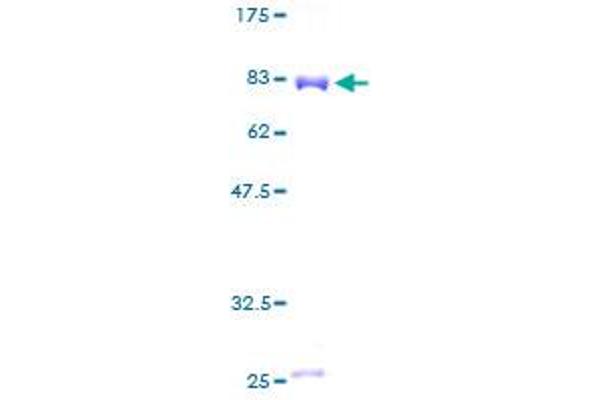 PGD Protein (AA 1-483) (GST tag)