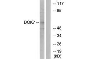 Western blot analysis of extracts from mouse brain cells, using DOK7 Antibody. (DOK7 Antikörper  (AA 10-59))