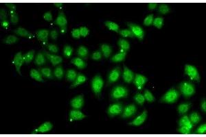Immunofluorescence analysis of U2OS cells using AFF1 Polyclonal Antibody (AF4 Antikörper)