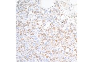Immunohistochemistry (IHC) image for anti-Suppressor of Ty 6 Homolog (SUPT6H) (AA 425-475) antibody (ABIN7453850)