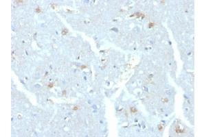 Formalin-fixed, paraffin-embedded human brain stained with UBE2C Mouse Monoclonal Antibody (CPTC-UBE2C-1) (UBE2C Antikörper)
