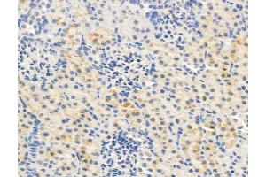 ABIN6263235 and ABIN6278161 at 1/100 staining Rat kidney tissue by IHC-P.