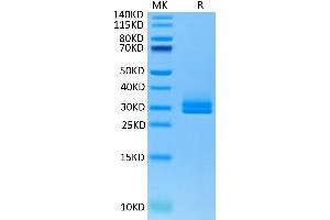 Human ANGPTL2 on Tris-Bis PAGE under reduced condition. (ANGPTL2 Protein (AA 260-493) (His-Avi Tag))
