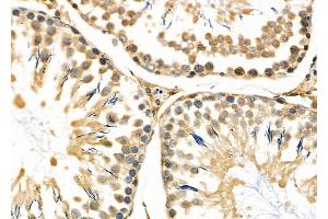ABIN6263302 and ABIN6266595 at 1/100 staining Rat testis tissue by IHC-P. (Matrix Metallopeptidase 23 (MMP23) (C-Term) Antikörper)