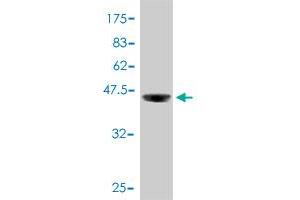 Western Blot detection against Immunogen (37 KDa) . (PRKAR1A Antikörper  (AA 1-100))