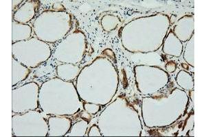 Immunohistochemical staining of paraffin-embedded Human thyroid tissue using anti-XPNPEP1 mouse monoclonal antibody. (XPNPEP1 Antikörper)
