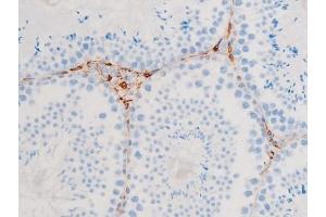 Immunohistochemistry (IHC) image for anti-Spleen tyrosine Kinase (SYK) (pTyr348) antibody (ABIN6255895)