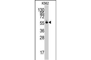 Western blot analysis of HARS polyclonal antibody  in K-562 cell line lysates (35 ug/lane).