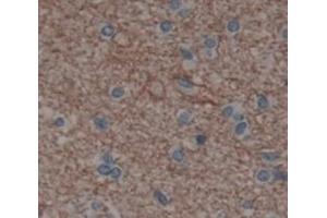 IHC-P analysis of Kidney tissue, with DAB staining. (IL20RA Antikörper  (AA 269-545))