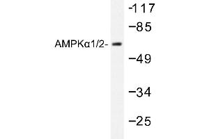 Image no. 1 for anti-Protein Kinase, AMP-Activated, alpha 1 Catalytic Subunit (PRKAA1) antibody (ABIN265305) (PRKAA1 Antikörper)