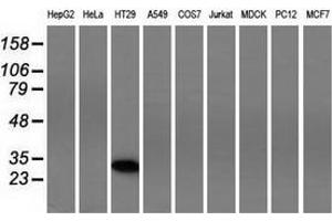 Western blot analysis of extracts (35 µg) from 9 different cell lines by using anti-FHL1 monoclonal antibody. (FHL1 Antikörper)