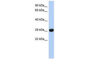 Image no. 1 for anti-Fructosamine 3 Kinase Related Protein (FN3KRP) (N-Term) antibody (ABIN6741474) (FN3KRP Antikörper  (N-Term))