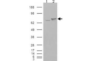 293 overexpressing XRCC6 and probed with XRCC6 polyclonal antibody  (mock transfection in first lane), tested by Origene.