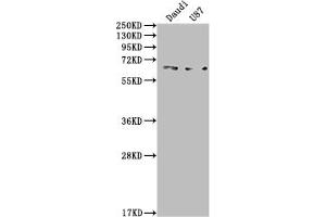 Western Blot Positive WB detected in: Daudi whole cell lysate, U87 whole cell lysate All lanes: ACVRL1 antibody at 1:2000 Secondary Goat polyclonal to rabbit IgG at 1/50000 dilution Predicted band size: 57 kDa Observed band size: 65 kDa (Rekombinanter ACVRL1 Antikörper)