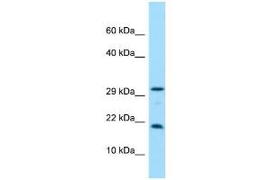 WB Suggested Anti-CRYGN Antibody Titration: 1. (CRYGN Antikörper  (C-Term))