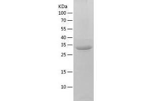 Western Blotting (WB) image for TatD DNase Domain Containing 1 (TATDN1) (AA 1-297) protein (His tag) (ABIN7125320) (TATDN1 Protein (AA 1-297) (His tag))