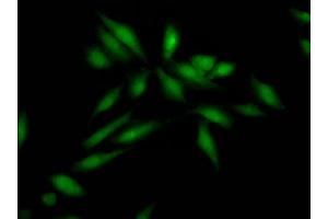 Immunofluorescence staining of Hela Cells with ABIN7127812 at 1:50, counter-stained with DAPI. (Rekombinanter SKP2 Antikörper)