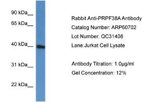 WB Suggested Anti-PRPF38A  Antibody Titration: 0. (PRPF38A Antikörper  (C-Term))
