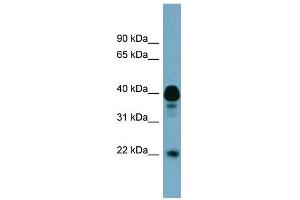 WB Suggested Anti-FAM45B Antibody Titration: 0. (FAM45B Antikörper  (Middle Region))