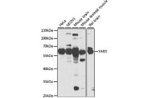 Western blot analysis of extracts of various cell lines, using YARS antibody (ABIN2560805) at 1:1000 dilution.