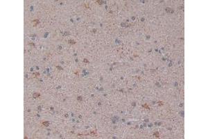 Figure. (LPCAT3 Antikörper  (AA 122-233))