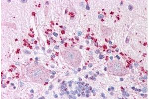 Immunohistochemistry (IHC) image for anti-Wingless-Type MMTV Integration Site Family, Member 7A (WNT7A) (Internal Region) antibody (ABIN1049482)