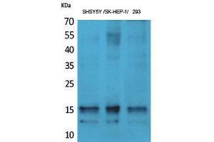 Western Blotting (WB) image for anti-Synuclein, alpha (SNCA) (pTyr125) antibody (ABIN3182994) (SNCA Antikörper  (pTyr125))
