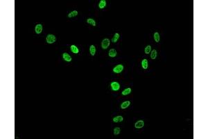 Immunofluorescent analysis of Hela cells using ABIN7139669 at dilution of 1:100 and Alexa Fluor 488-congugated AffiniPure Goat Anti-Rabbit IgG(H+L) (HIST1H3A Antikörper  (3meLys36))