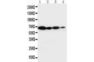 Anti-NOX2/gp91phox antibody, Western blotting Lane 1: HELA Cell Lysate Lane 2: JURKAT Cell Lysate Lane 3: MCF-7 Cell Lysate Lane 4: SMMC Cell Lysate