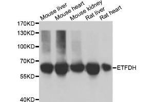 Western blot analysis of extracts of various cell lines, using ETFDH antibody. (ETFDH Antikörper)