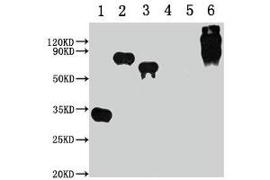 Western Blot Positive WB detected in: 1-3 lanes: E-tagged fusion protein, 4-5 lanes: Recombinant protein without E-tagged, 6 lane: BSA-E-Tag All lanes: E-Tag antibody at 1:1000 Secondary Goat polyclonal to Mouse IgG at 1/10000 dilution Predicted band size: 30, 68, 55, 67-157 kDa Observed band size: 30, 68, 55, 67-157 kDa (E Tag Antikörper)