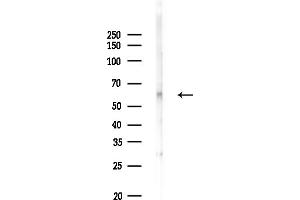 anti-Zinc Finger Protein 57 Homolog (ZFP57) (C-Term) antibody