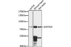 Western blot analysis of extracts of various cell lines, using ENTPD4 antibody (ABIN7266893) at 1:1000 dilution. (ENTPD4 Antikörper  (AA 350-470))