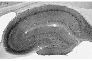 Adult rat hippocampus immunohistochemistry.
