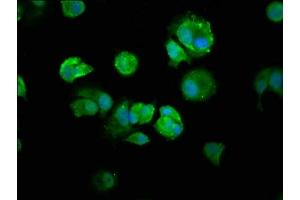 Immunofluorescence (IF) image for anti-Nuclear Factor of kappa Light Polypeptide Gene Enhancer in B-Cells 1 (NFKB1) (AA 1-961) antibody (ABIN7161781)