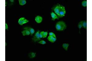 Immunofluorescence staining of MCF-7 cells with ABIN7161781 at 1:250, counter-stained with DAPI.
