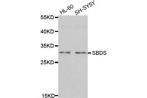 Western Blotting (WB) image for anti-Shwachman-Bodian-Diamond Syndrome (SBDS) antibody (ABIN1980243) (SBDS Antikörper)