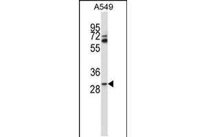 TATDN1 anticorps  (AA 115-143)