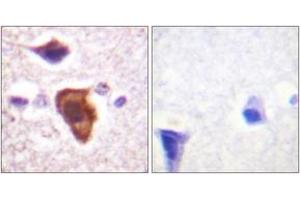 Immunohistochemistry analysis of paraffin-embedded human brain tissue, using CD88/C5aR (Ab-338) Antibody. (C5AR1 Antikörper  (AA 301-350))