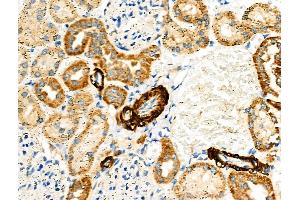 ABIN6257298 and ABIN6275372 at 1/100 staining Rat kidney tissue by IHC-P.